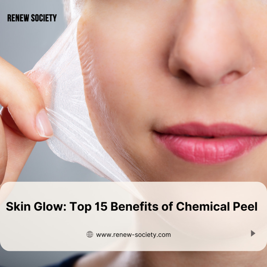 Skin Glow Top 15 Benefits of Chemical Peel McKinney, TX