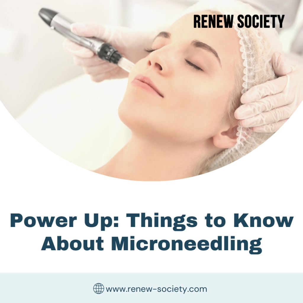Power Up: Things to Know About Microneedling