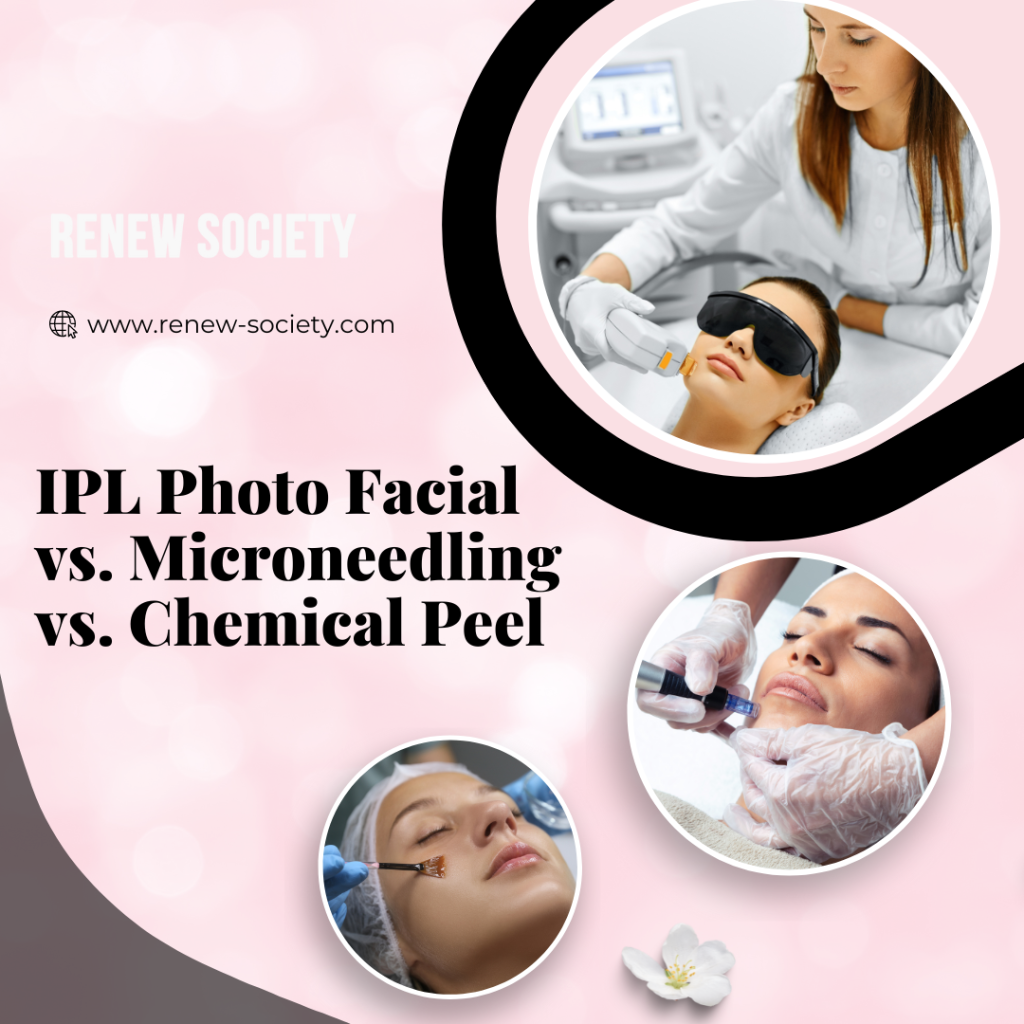 IPL Photo Facial vs. Microneedling vs. Chemical Peel