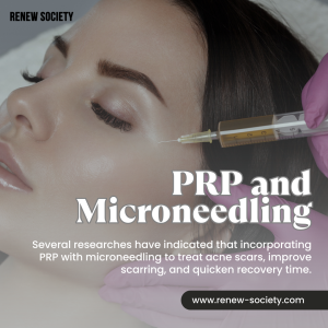 PRP and Microneedling